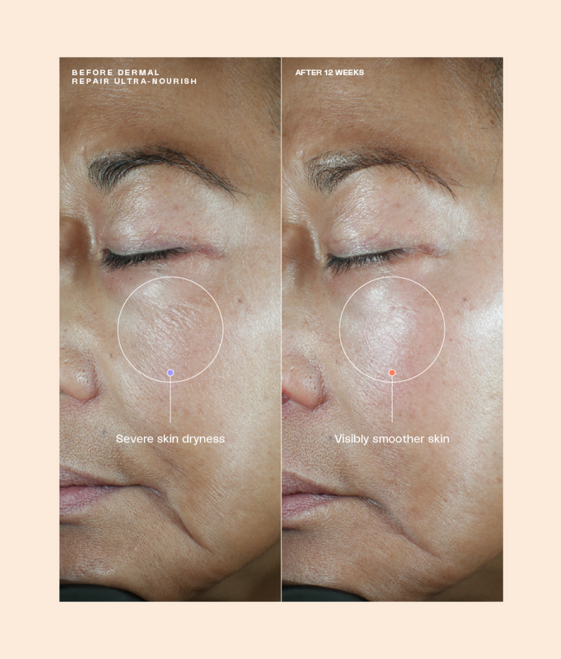 Sente Dermal Repair Ultra Nourish