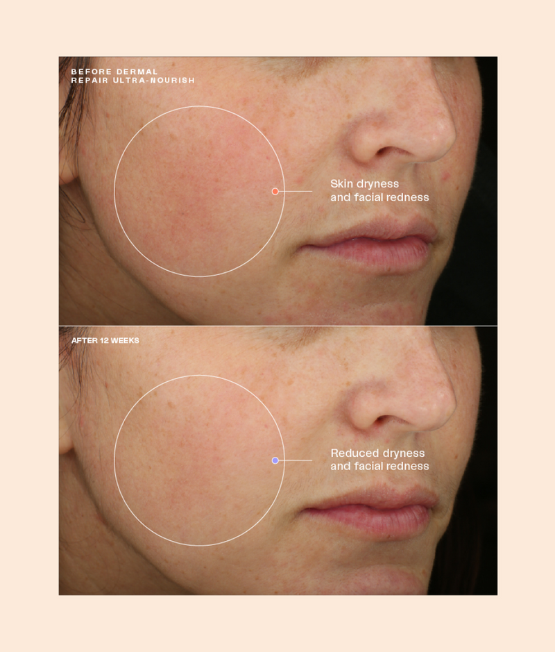 Sente Dermal Repair Ultra Nourish