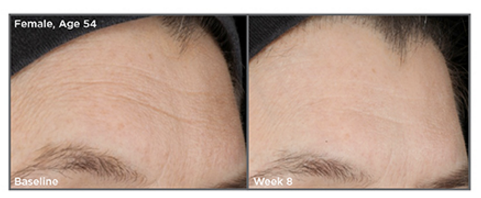 SkinMedica Retinol Complex .5