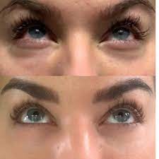 Skin Medica TNS EYE Repair