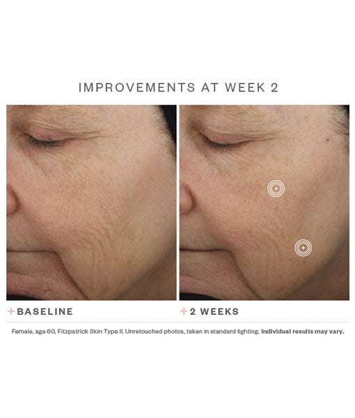 SkinMedica TNS Advanced+ Serum