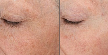 SkinMedica TNS Eye Repair 0.5 fl. oz